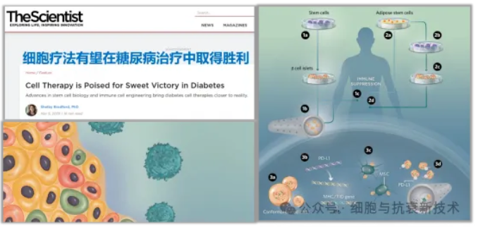 細胞療法有望在糖尿病治療中取得勝利
